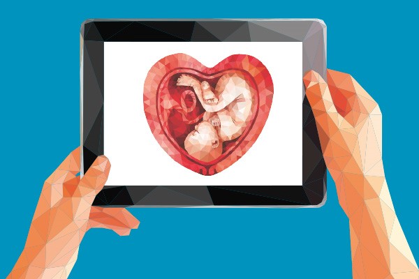 Zwei Hände halten ein Tablet hoch. Auf dem Tablet ist ein Herz in polygoner Optik zu sehen, darin schwimmt ein Fötus wie im Bauch einer schwangeren Frau